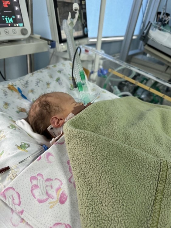 Младенца с пороком сердца прооперировали в Киеве сразу после кесарева сечения