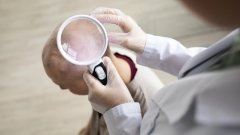 МОЗ затвердило Уніфікований клінічний протокол меддопомоги при дерматофібросаркомі, що вибухає /Magnific