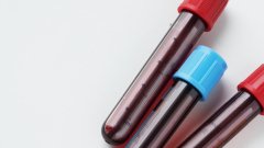 В Україну доставлено майже 2 мільйони тест-систем на гепатити B і C /freepik