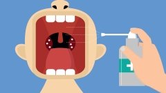 стрептококковая ангина