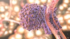Онкопрепарат від Genmab зміг впоратися з раком ендометрію самотужки