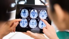 Ведущий кандидат Contineum Therapeutics не сработал при рассеянном склерозе