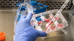 Halozyme и Vertex договорились совместно использовать технологию Hypercon