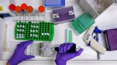 Медучреждения начинают задумываться о неэффективности собственных лабораторий и аутсорсинге диагностики