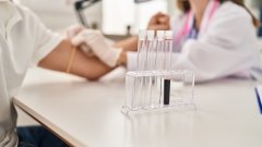 Украинцы смогут пройти бесплатное тестирование в мобильных амбулаториях с 17 по 24 ноября /freepik
