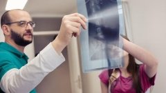 НПВС связаны с замедлением повреждения позвоночника при аксиальном спондилоартрите