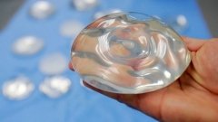 Allergan продолжает выискивать опасные грудные имплантаты