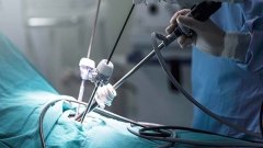 Госпитализация с холедохолитиазом: задержка холецистэктомии связана со значительно большим риском осложнений