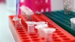 Професора медицини звинувачують у підтасовці клінічних даних. Спонсор підставив ученого?