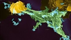 Імбир пропонують застосовувати в терапії аутоімунних захворювань