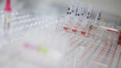 Novartis заинтересовалась лечением серповидно-клеточной анемии