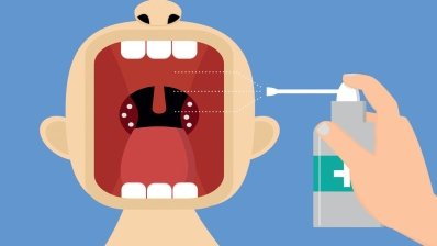 Біль у горлі: як відрізнити «справжню» ангіну від вірусної інфекції