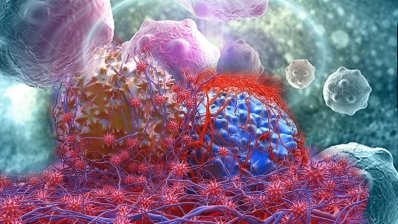 Candel Therapeutics предлагает вариант мультимодальной терапии рака поджелудочной железы