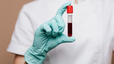 Система качества и контроля заготовки крови в Украине будет соответствовать евростандартам /freepik