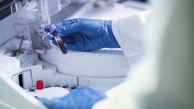 Уряд затвердив критерії оцінки ризику у сфері донорської крові /freepik