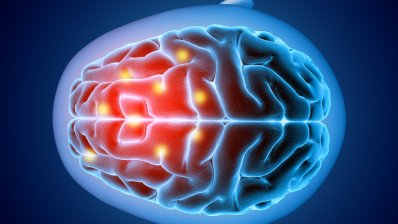 Пристрій Novocure уповільнює метастазування у головному мозку