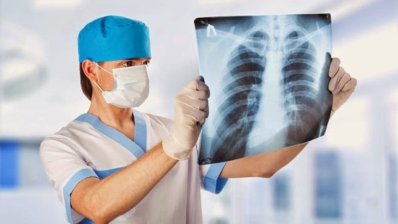 Профілактичне лікування туберкульозу: Україна одержала рифапентин