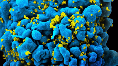 Препарат клеточной терапии поможет уничтожить ВИЧ силами организма пациента