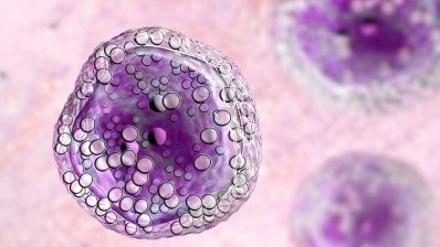 Eli Lilly наближається до реєстрації Jaypirca в першій лінії терапії лімфоми