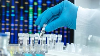 Британский регулятор поддержал применение фармакогенетического теста в условиях постинсульта