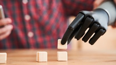 Esper Bionics дає українцям можливість отримати біонічну руку безоплатно