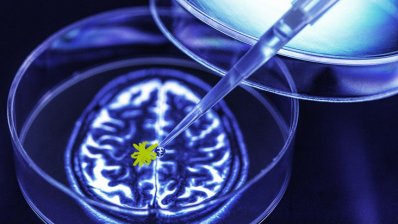 Экспериментальный препарат от болезни Альцгеймера подтвердил эффективность в опорном испытании