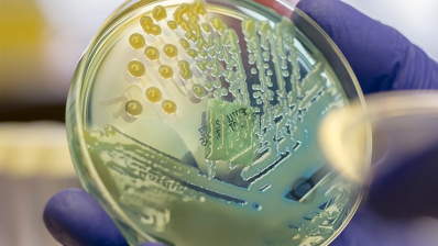 GSK лицензирует инновационный антибиотик