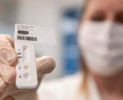 ГП «Медзакупки Украины» приобрело 1,5 млн корейских тестов на антиген