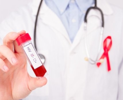 В США хвору на рак крові жінку вилікували від ВІЛ
