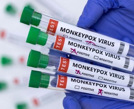 Оспа обезьян: в ВОЗ объявили чрезвычайную ситуацию из-за распространения болезни /reuters