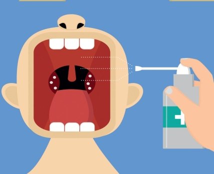 Боль в горле: как отличить «настоящую» ангину от вирусной инфекции