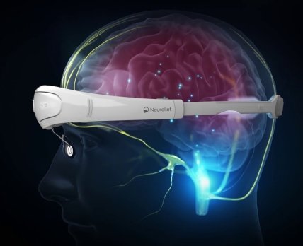 Израильская компания Neurolief разработала устройство для лечения мигрени