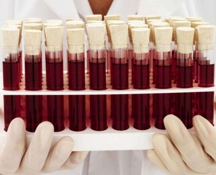 Еврокомиссия оценит украинскую систему переливания крови