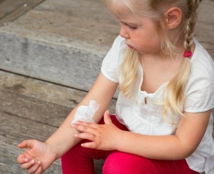 Incyte анонсировала положительные результаты испытания крема руксолитиниб у детей с атопическим дерматитом