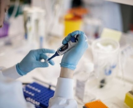 Украинская компания создала новый тест на коронавирус