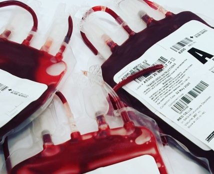 Вченим вдалося виростити еритроцити – це дозволить створити великі запаси рідкісних груп крові