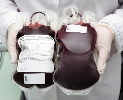 Объем обязательного обеспечения донорской кровью уменьшен на 7,6%