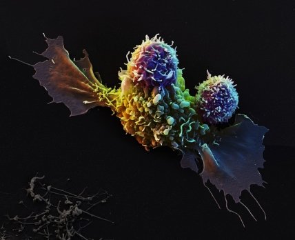 Как лекарства побеждают рак: невероятные изображения, увеличенные в 2000 раз