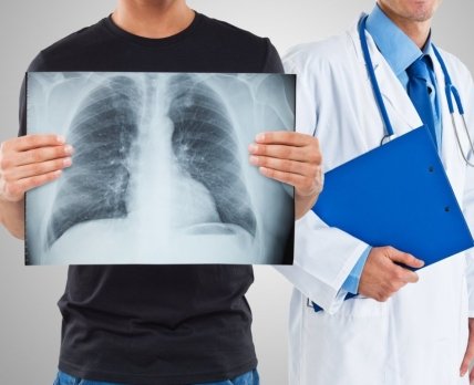 ГЕЦ розповів про оновлені стандарти медичної допомоги при туберкульозі