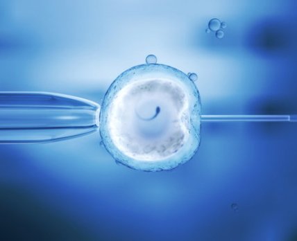 Вспомогательные репродуктивные технологии связаны с повышенным риском развития рака у детей