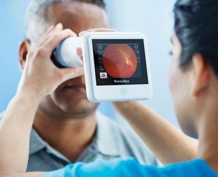 В Закарпатской области запустили программу скрининга диабетической ретинопатии