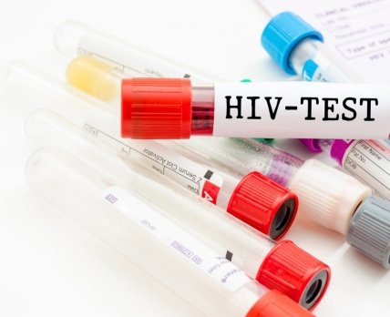 Друга в історії пацієнтка з ВІЛ позбавилася вірусу без лікування