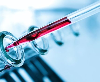FDA одобрило первый анализ крови на вирус Зика для рутинного использования