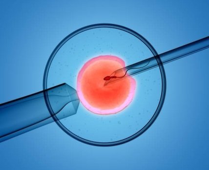 Репродуктологи України відреагували на законопроект «Про застосування допоміжних репродуктивних технологій»