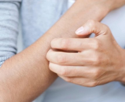 Ревмапатологии можно заподозрить по кожным симптомам