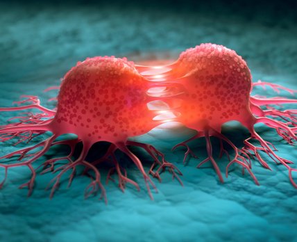 Новий онкомаркер допомагає виявити рак шлунка з точністю майже 90%