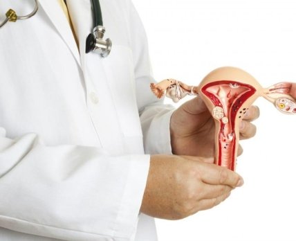Найден способ снизить менструальные кровотечения при фибромиоме матки