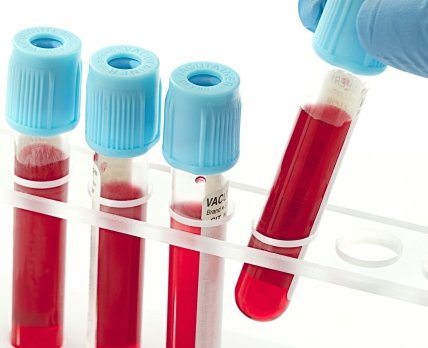 Стандартний аналіз крові може показати ризик злоякісних пухлин