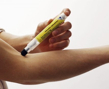 Алергія на ПЕГ – не привід відмовитися від ковід-вакцинації