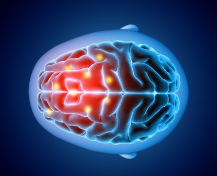 Устройство Novocure замедлило метастазирование в головном мозге